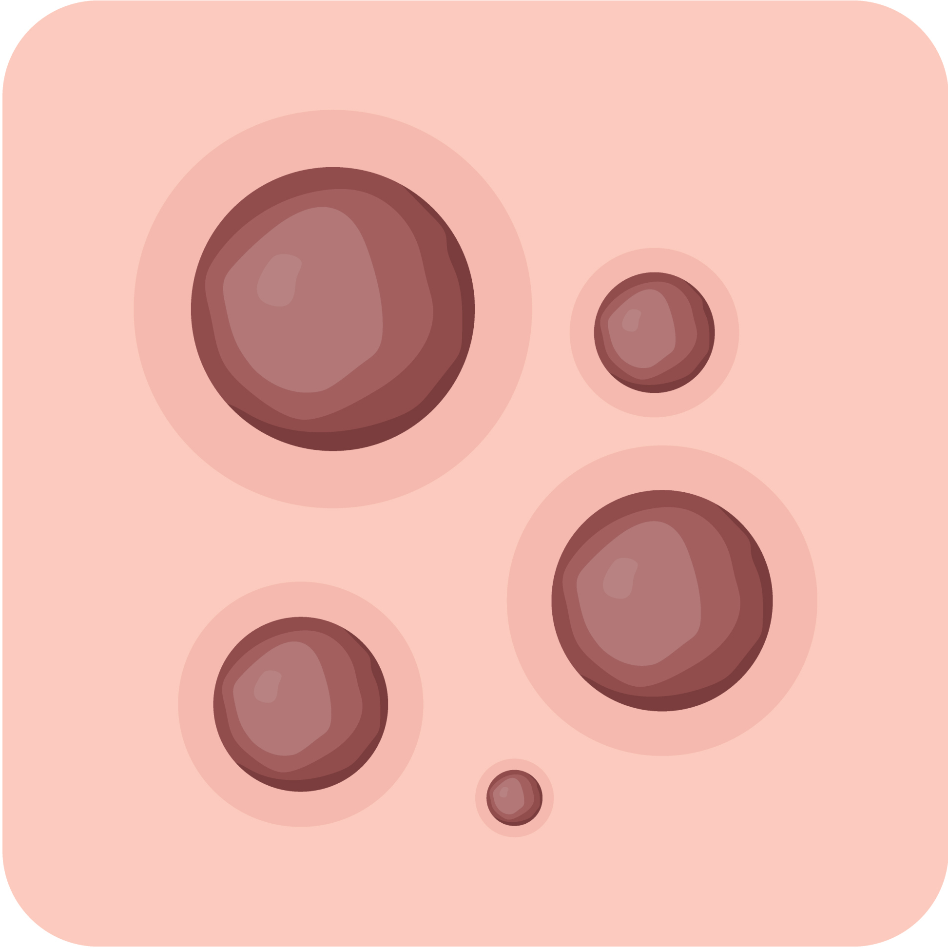 Nodule